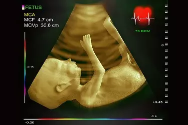 foetal echocardiography in gurgaon, cost of foetal echo in gurgaon, best radiologist for doing foetal echo in gurgaon, best diagnostic centre in gurgaon